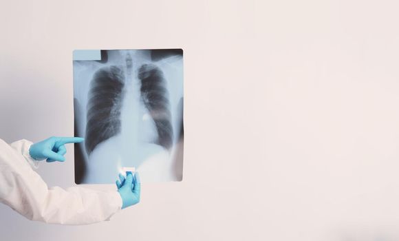 Xray film of Covid 19 lung damage and holding by doctor hand in medical glove and PPE or Personal Protection Equipment suit. Studio shot white background. Coronavirus pandemic and Healthcare medical concept.