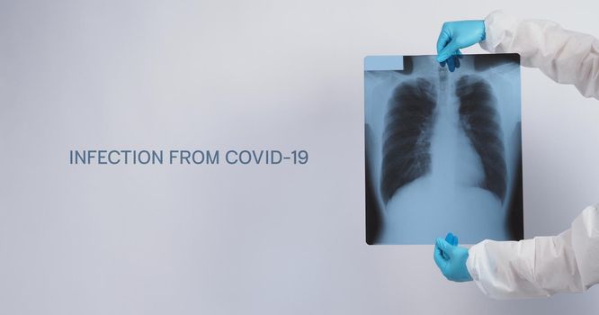 Xray film of Covid 19 lung damage and holding by doctor hand in medical glove and PPE or Personal Protection Equipment suit. Studio shot white background. Coronavirus pandemic and Healthcare medical concept.