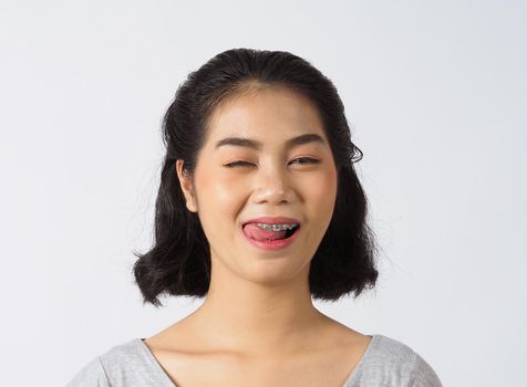 Dental brace beautiful girl smiling looking on a camera. white teeth with blue braces. Dental care. Asian teen woman smile with orthodontic accessories. Cosmetic dentistry, orthodontics treatment. white background studio.