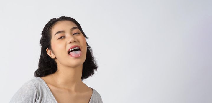 Dental brace teen girl smiling looking on a camera. white teeth with blue braces. Dental care. Asian woman smile with orthodontic accessories. Cosmetic dentistry, orthodontics treatment. studio shot.