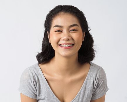 Dental brace teen girl smiling looking on a camera. white teeth with blue braces. Dental care. Asian woman smile with orthodontic accessories. Cosmetic dentistry, orthodontics treatment. studio shot.