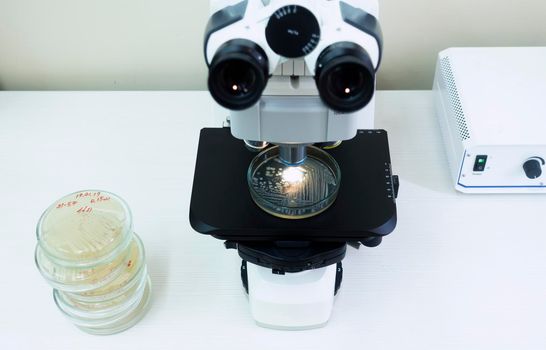 A Petri dish with bacteria stands under a large microscope, next to it is a stack of Petri dishes for analysis. Microscopy of bacteria under the microscope.