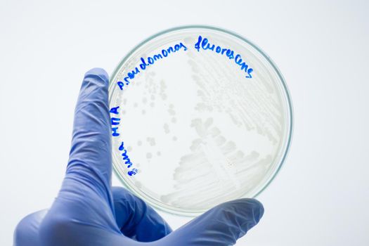 The scientist examines a cup of petrie with colonies of bacteria on a white background. Hands in blue gloves hold a petri dish. A scientist holding a petri dish in front of him.