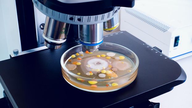 A petri dish with multi-colored colonies of bacteria lies on a microscope slide. Microscope for the study of bacteria.