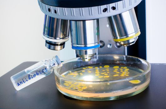 Checking the effect of antibiotics on bacteria under a microscope. A bottle of antibiotics lies on a Petri dish with yellow bacteria.