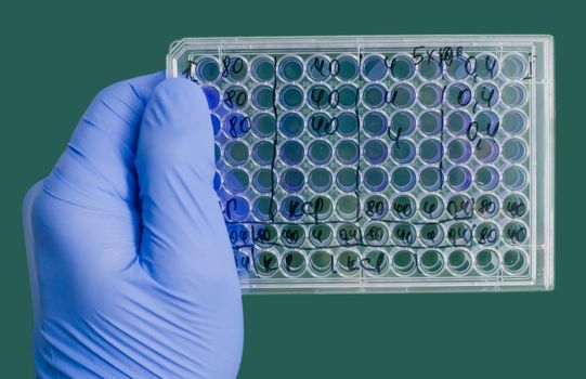 A blue-gloved hand holds a medical plate. Plate with the results of the experiment in the hand of the scientist.