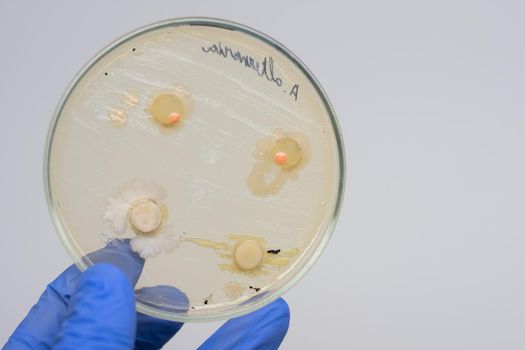 Mold test in a man’s house. Analysis of bacterial colonies. Close-up scientist holding a petri dish with colonies of bacteria in front of him. Antibiotics act on bacteria in a petri dish.