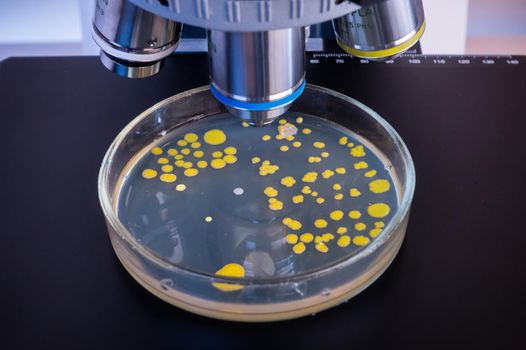 A petri dish with bacteria lies on the microscope table under the lenses. Analysis of bacterial culture under a microscope. Study of bacteria under a microscope.