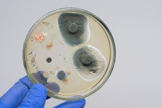 Close-up scientist holding a petri dish with colonies of bacteria in front of him. Antibiotics act on bacteria in a petri dish. Mold test in a man’s house.