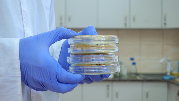 The doctor is holding a stack of Petri dishes in front of him, standing in the laboratory, close-up.