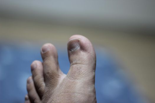 Healthy toe with blurred background. Closeup of Healthy bare feet with fingers and nails.