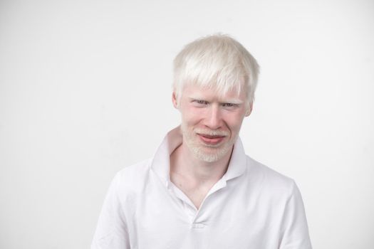 albinism albino man in studio dressed t-shirt isolated on a white background. abnormal deviations. unusual appearance. skin abnormality