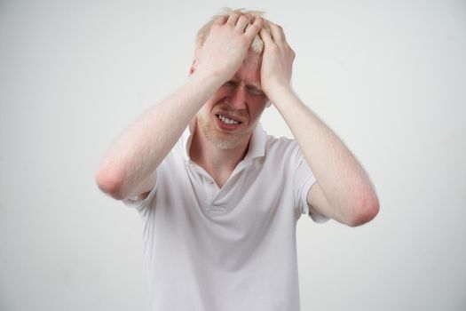 albinism Sad albino man white skin hair studio dressed t-shirt isolated white background. abnormal deviations. unusual appearance. skin abnormality Beautiful people with special appearance.