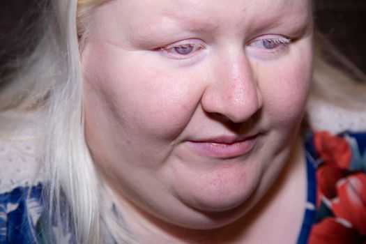 Extreme close up of a sad albino woman