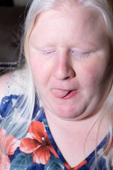 Obese, albino woman licking crumbs off her lips