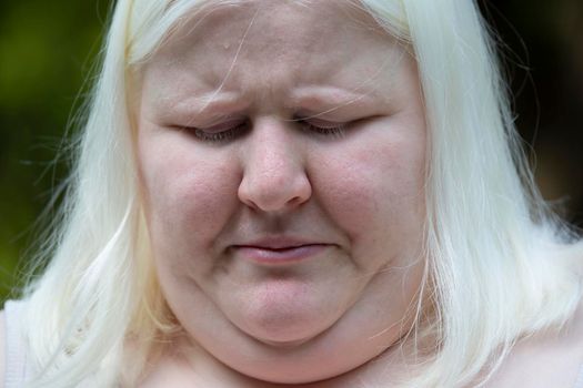 Close up of an albino woman looking down
