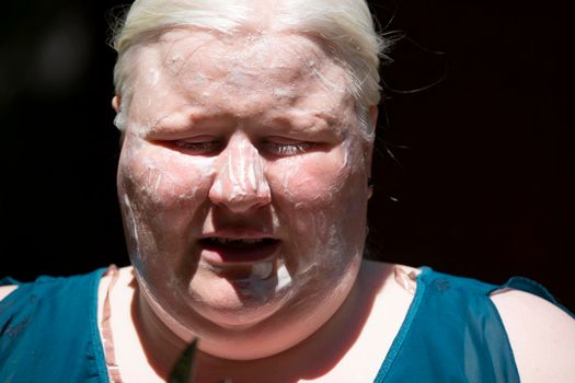 Close up of an albino woman slathered in sun screen