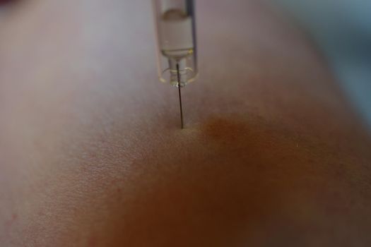 close-up of an injection before injecting it into the arm