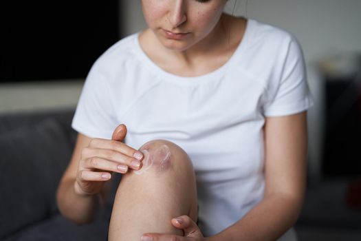 Close up of a person rubbing cream for healing injured knee joint. Bruise on the knee. Leg pain.