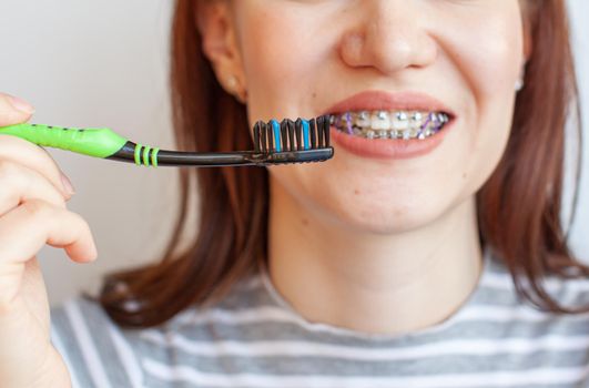 Braces in the smiling mouth of a girl. Close-up photos of teeth and lips. Smooth teeth from braces. On the teeth of elastic bands for tightening teeth. Photo on a light solid background.