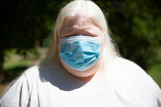 Close up of an albino woman wearing a medical mask