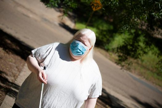 Close up of an albino woman wearing a medical mask