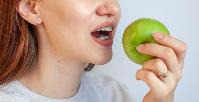 A girl with braces on her teeth wants to bite a green apple. Close-up photos of teeth and lips. Smooth teeth from braces. Photo on a light solid background.