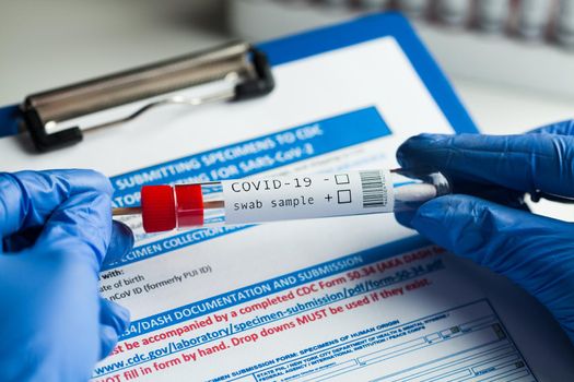 rt-PCR COVID-19 virus disease diagnostic test,lab technician wearing blue protective gloves holding test tube with swabbing stick,swab sample equipment kit & CDC form specimen submitting guidelines