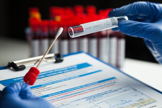 Lab technician holding swab collection kit,Coronavirus COVID-19 specimen collecting equipment,DNA nasal and oral swabbing for PCR polymerase chain reaction laboratory testing procedure and shipping