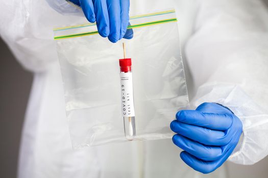 Coronavirus COVID-19 testing,swab collection equipment,sterile vacutainer with swabbing stick,closeup of hands holding a packaging bag containing specimen self collection kit,at home point of care