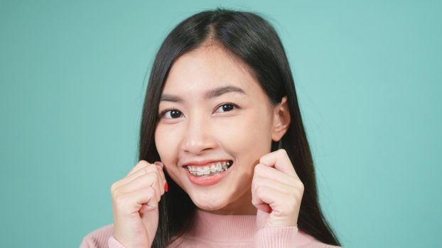Portrait young Asian beautiful woman smiling wear silicone orthodontic retainers on teeth isolated on blue background, Teeth retaining tools after removable braces. Dental hygiene and health concept