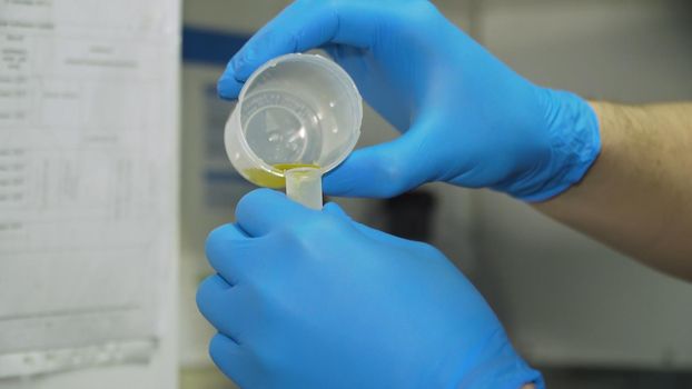 Doctor holds in his hand container with urine sample for analysis and research in medical laboratory. Medical urine test. Healthcare And Medicine