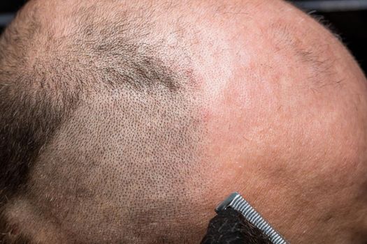 Man shaving or trimming his hair using a hair clipper