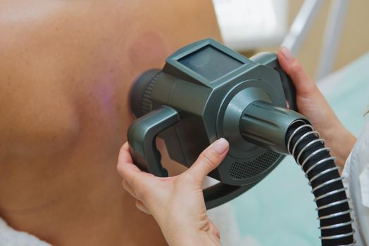 Cosmetologist doing massage with apparatus on female back, close up.