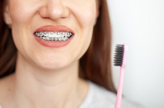 A girl with braces on her white teeth is brushing her teeth with a toothbrush. Straightening and dental hygiene. Dental care.