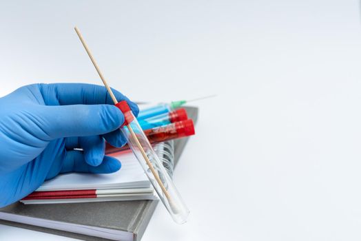 Doctor's hand with medical glove holding a blood probe in front of a lab Close up of nurses hands holding buccal cotton swab and test tube ready to collect DNA from the cells.