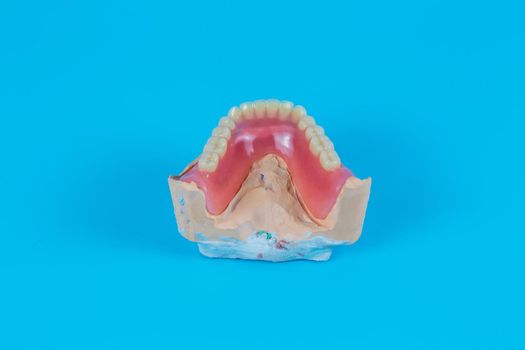 Plaster mock-up of the jaw with gums and teeth on a blue background. Artificial jaw, visual aid for dentists and patients.