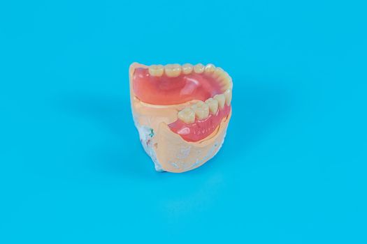 Plaster mock-up of the jaw with gums and teeth on a blue background. Artificial jaw, visual aid for dentists and patients.