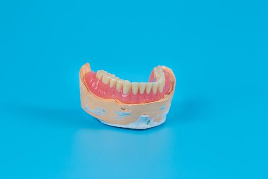 Plaster mock-up of the jaw with gums and teeth on a blue background. Artificial jaw, visual aid for dentists and patients.