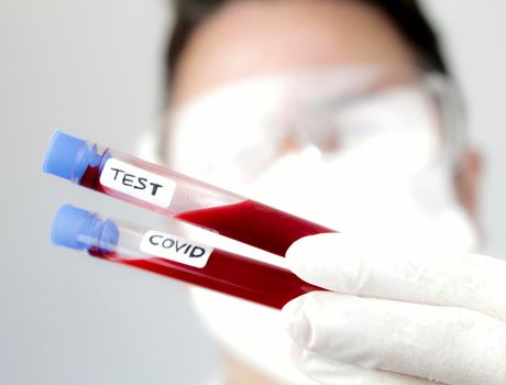 Madrid, Spain- May 2, 2020: Laboratory assistant wearing protective glasses and surgery gloves holding test tube of Covid-19 virus