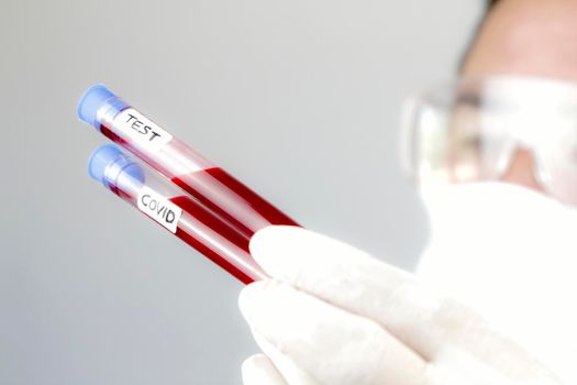 Madrid, Spain- May 2, 2020: Laboratory assistant wearing protective glasses and surgery gloves holding test tube of Covid-19 virus