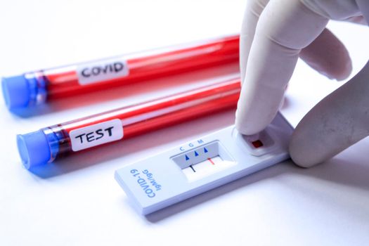 Medical worker placing blood sample on Rapid Diagnostic Test identifying antibodies for Coronavirus SARS-CoV-2 COVID-19