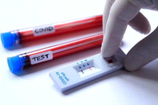 Medical worker placing blood sample on Rapid Diagnostic Test identifying antibodies for Coronavirus SARS-CoV-2 COVID-19