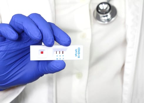 Medical worker holding positive rapid Diagnostic Test cassette identifying antibodies for Coronavirus SARS-CoV-2 COVID-19