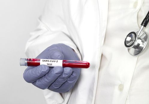 Medical worker holding test tube with blood sample for Covid-19 virus test