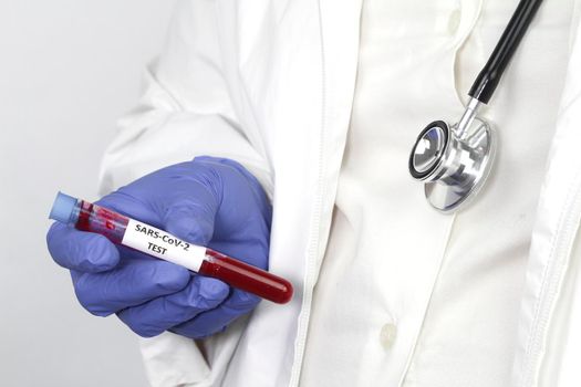 Medical worker holding test tube with blood sample for Covid-19 virus test
