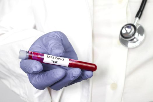 Medical worker holding test tube with blood sample for Covid-19 virus test