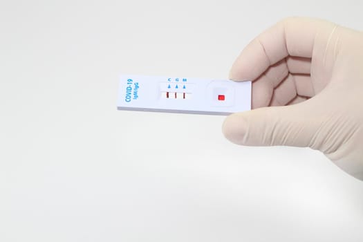 Medical worker holding positive rapid Diagnostic Test cassette identifying antibodies for Coronavirus SARS-CoV-2 COVID-19