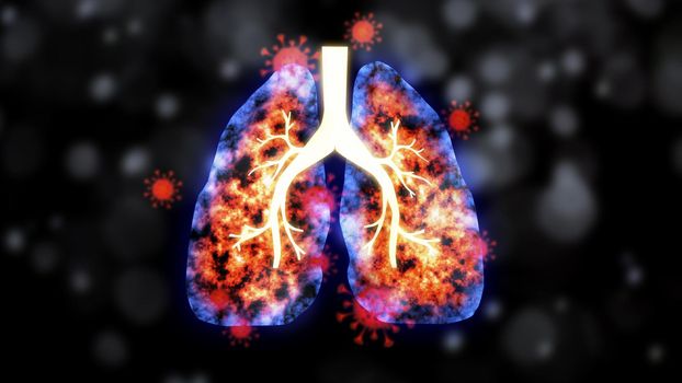 Lung infection with coronavirus on dark background