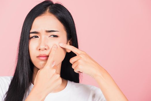 Portrait teenage Asian beautiful young woman having skin problems squeezing pimples on her face, studio shot on pink background, with copy space, Thai female acne, beauty care concept